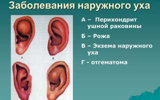 Экзема в ушах: провоцирующие факторы заболевания, разновидности, лечение и прогноз