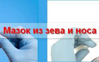 Мазок из зева и носа на стафилококк: норма, расшифровка